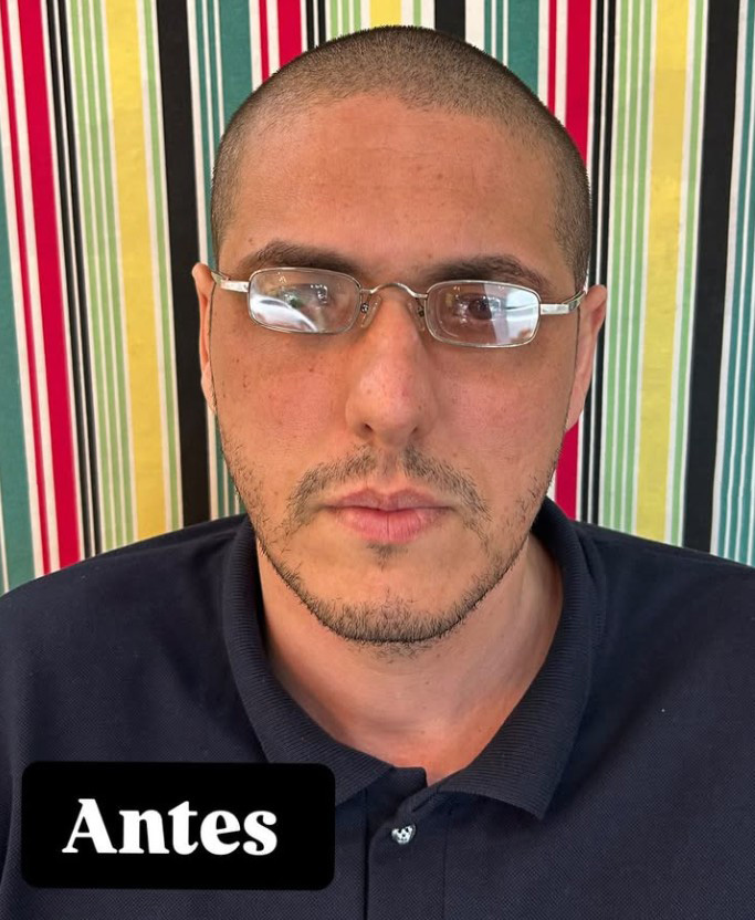 antes visa